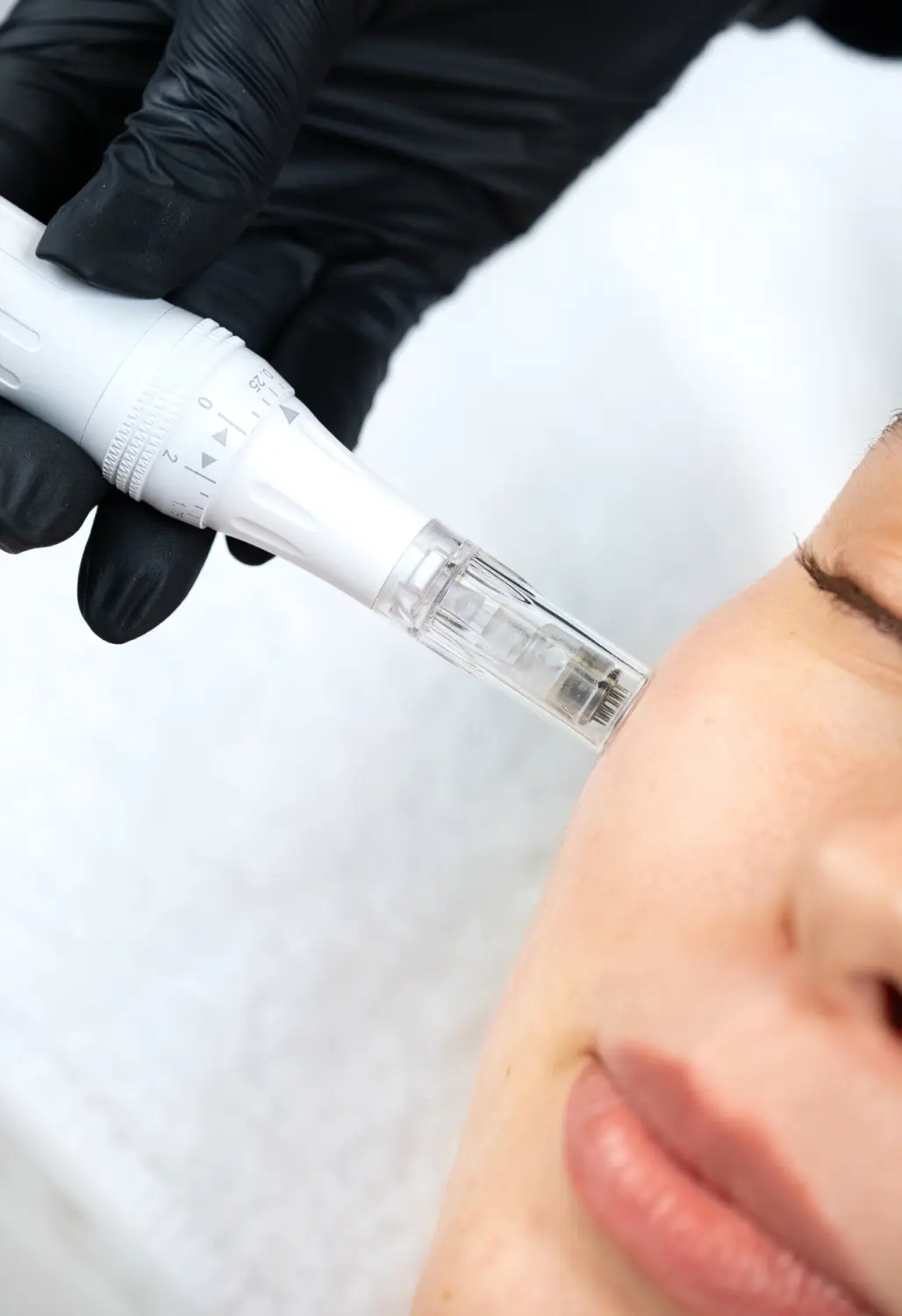 Microneedling von Great Lashes & Brows Beauty Studio