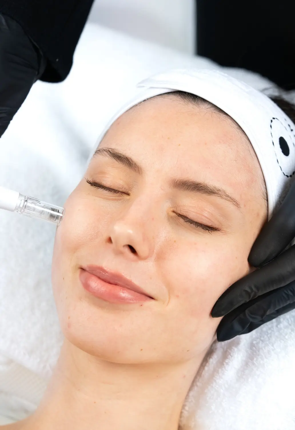 Microneedling von Great Lashes & Brows Beauty Studio