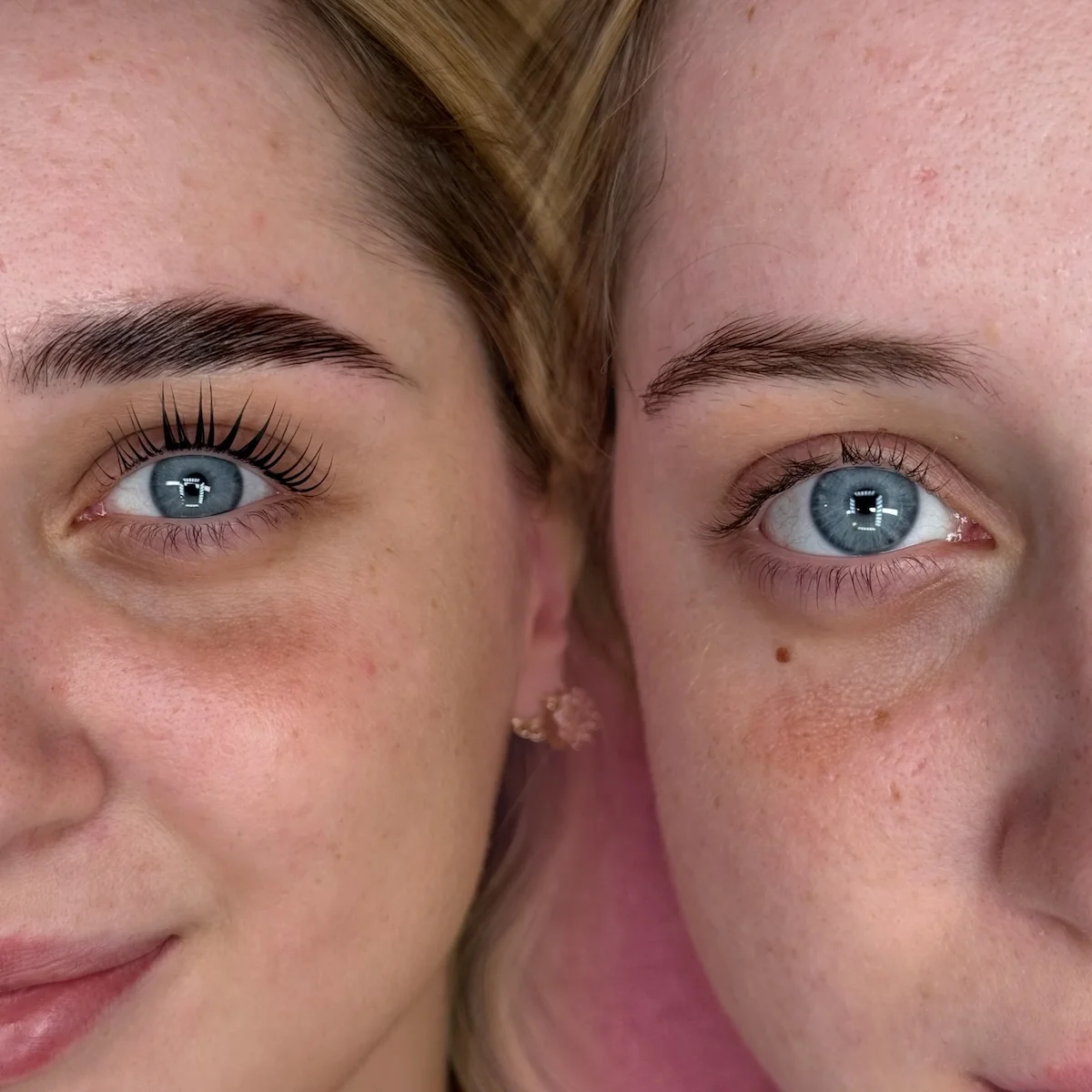 Lymphdrainage von Great Lashes & Brows Beauty Studio